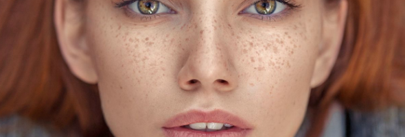 ¿Cuál es el significado de las pecas en ciertos lugares del cuerpo?